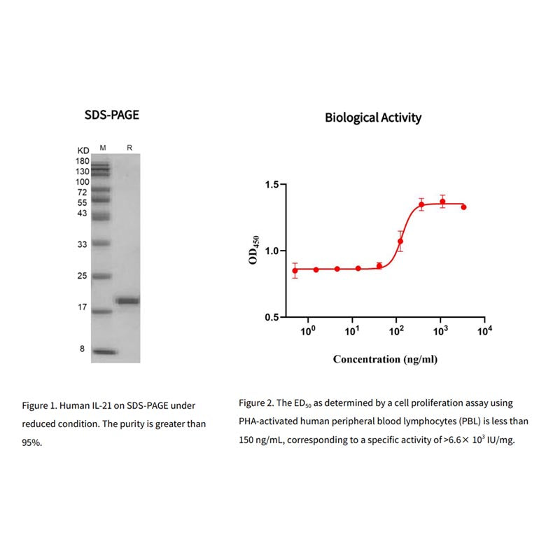 Recombinant Human IL-21 Protein,Flag tag _90120ES
