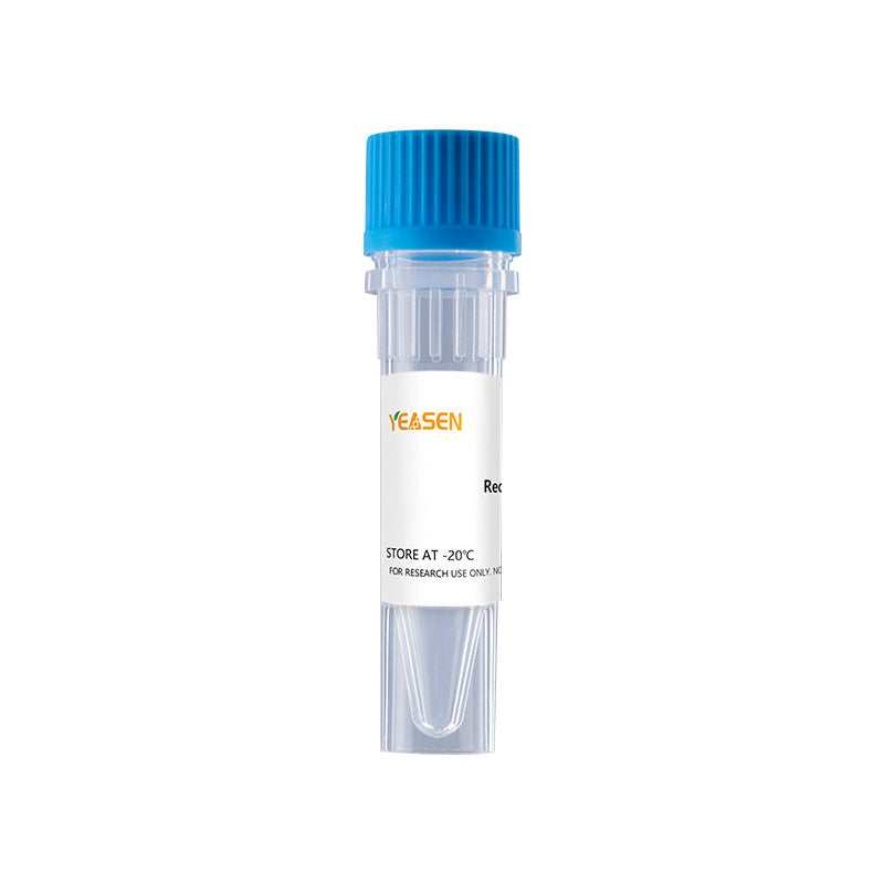 Recombinant Mouse GM-CSF Protein£¬His Tag _91115ES
